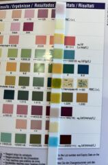 Urine test
