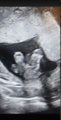 Unsure of Gender