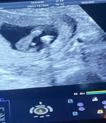Potty shot - is this a boy?