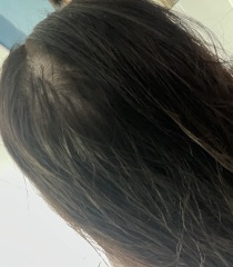 Balding? Thinning? Cowlick?