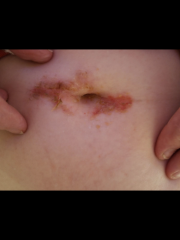 Does this look infected?