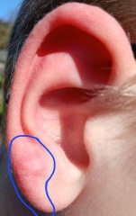 Medics of the Internet what is going on here? Pics attached
