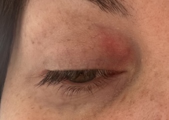 Eye Pic…what is this?