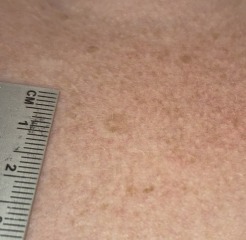 How urgently do I need to get this checked?