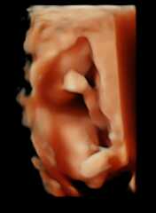 Due in September - over 40 :)