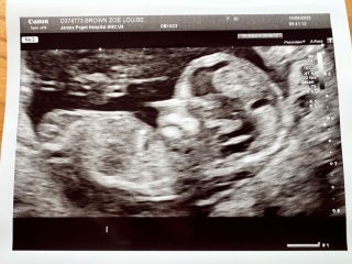 Any gender guesses please?!