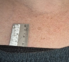 How urgently do I need to get this checked?
