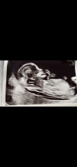 Boy or girl?