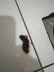 Is this miscarriage?