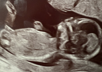 Guess twin gender