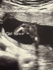 Potty gender scan