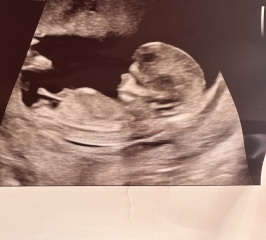 Boy or girl?