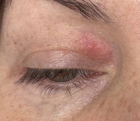 Eye Pic…what is this?