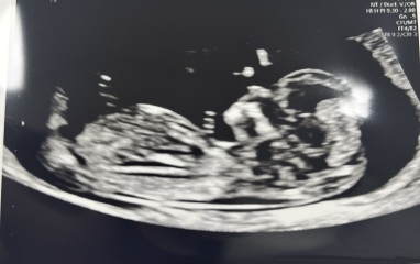 Is there a nub showing on this scan? Help please!!