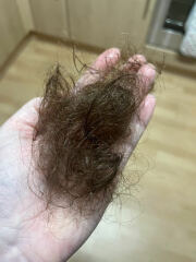 Female hair loss - please help