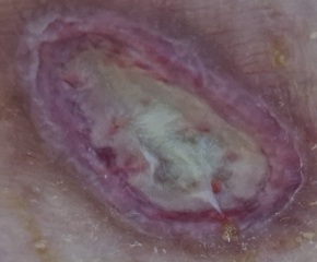 Random raw skin thing - ideas?