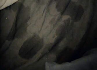 Night sweats and weird bruising