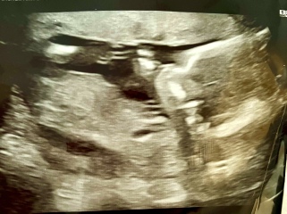 15+3 gender guesses