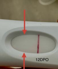 LINE EYE VETERANS NEEDED!❤️