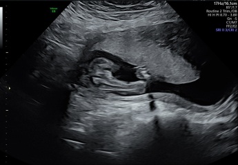 Is this definitely a girl?