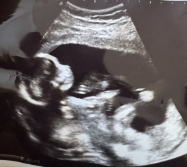 Gender guesses