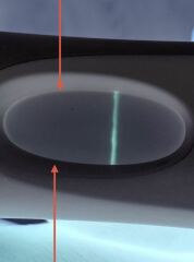 April 2025 TTC Support Group