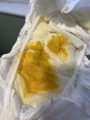 Mucus in baby poo? *pictures*