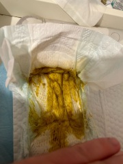 Baby Poo - is this normal?! **trigger warning - pic attached**
