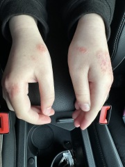 Any skin experts out there?!