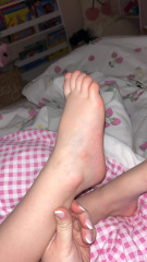 Does this look like chicken pox? Also I’m pregnant so need advice if so!