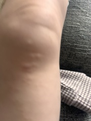 Any idea what this is?