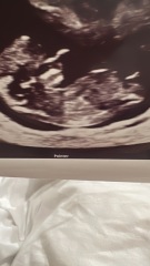 Girl or boy?