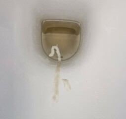 Mucous plug?