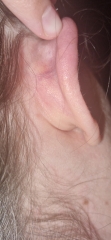 Painful behind my ear