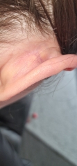 Painful behind my ear