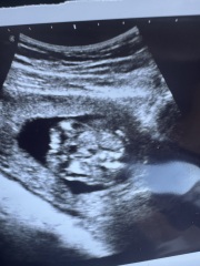 Gender guesses
