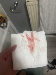 Implantation or period?