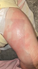 Does anyone know what this rash could possibly be?