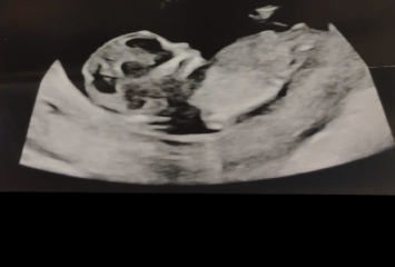 Has anyone been told the gender at 12 week scan?