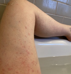 Unknown rash getting me down