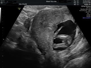 Potty shot - is this a boy?