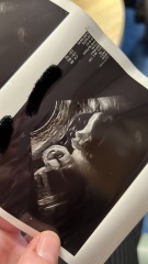 Facing termination at 9 weeks pregnancy