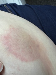 March 2025 Starters thread 4