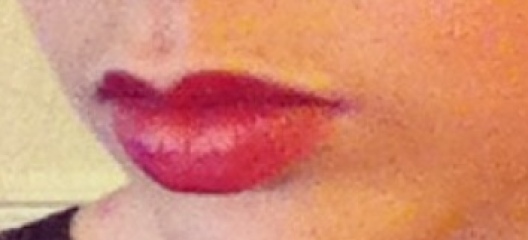 Did your lips wrinkle when dissolving lips?