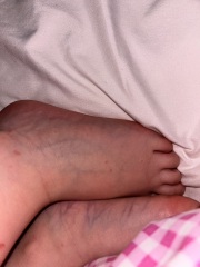 Does this look like chicken pox? Also I’m pregnant so need advice if so!