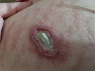 Random raw skin thing - ideas?