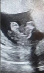 Unsure of Gender