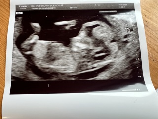 Any gender guesses please?!