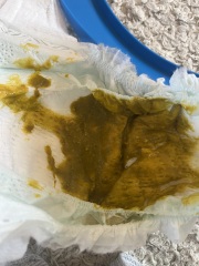 Allergy poop? Photo attached (sorry!)