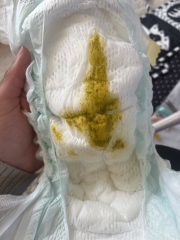 Allergy poop? Photo attached (sorry!)